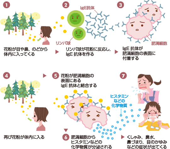 のど 花粉 症 のどコラム｜龍角散のど研究室｜のどの健康に役立つ情報をお届け